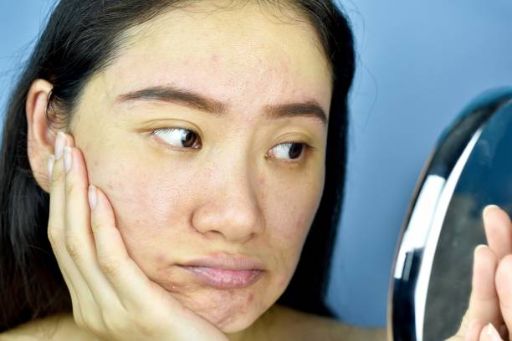 A woman holding her face and looking in the mirror. She is worried on what causes dull skin on her face. 