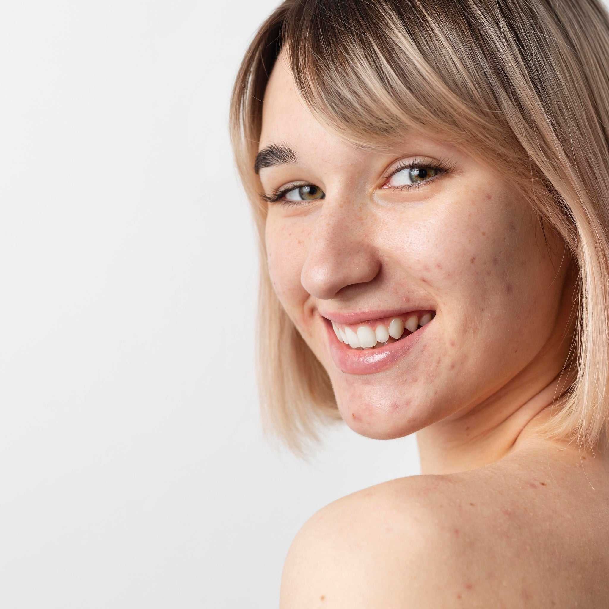 Does Collagen Supplement Help Acne or Make It Worse? What the Research Says