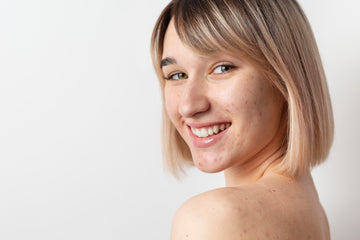 Does Collagen Supplement Help Acne or Make It Worse? What the Research Says